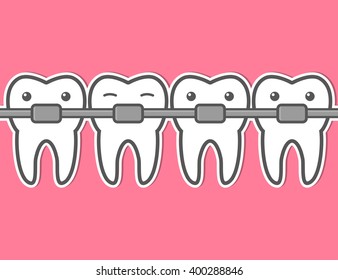 Cartoon Tooth Braces. Vector Illustration