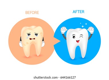 Cartoon tooth character before and after. Whiten yellow teeth. Dental care concept,  illustration. 