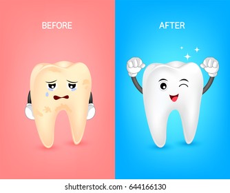 Cartoon tooth character before and after. Whiten yellow teeth. Dental care concept,  illustration. 