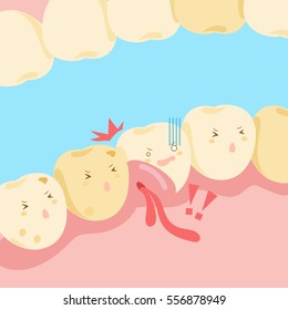 diente de caricatura con hinchazón gingival y sangrado