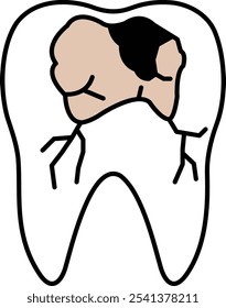 A cartoon of a tooth with a hole in it. The tooth is missing a portion of its root