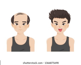 Cartoon vector illustration of a bald man with new hair.