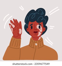 Cartoon vector illustration of dark-skinned girl with a violation of skin pigmentation, vitiligo. A beautiful girl loves her body