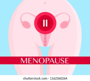 Cartoon vector illustration of a women's menopause. 