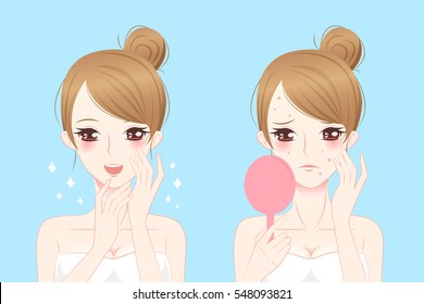 cartoon woman with acne before and after svg