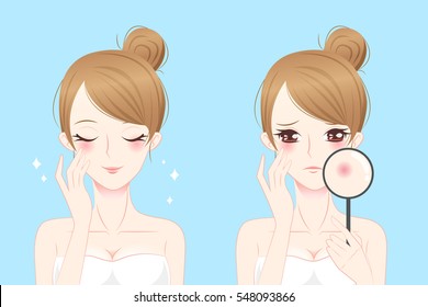 cartoon woman with acne before and after