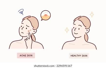 cartoon woman with acne skin problem. Hand drawn style vector design illustrations. - Shutterstock ID 2296591167