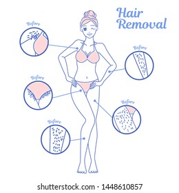 cartoon woman with hair problem before and after