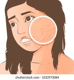 cartoon woman with skin dry and feel bad on white background