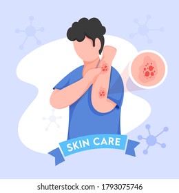 Cartoon Young Boy Itching His Hands and Molecules Decorated on Blue Background for Skin Care.