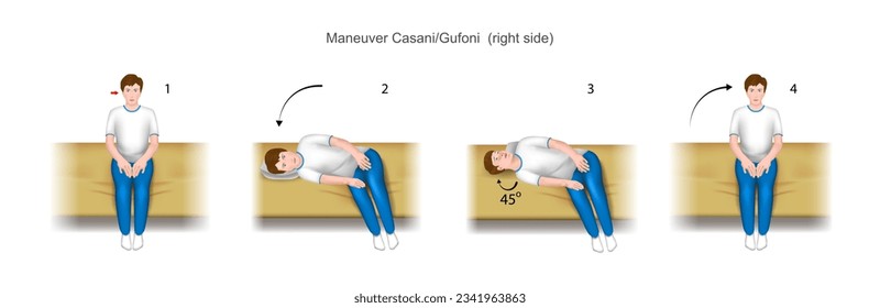 Casani Gufoni maneuver, a practical guide to the treatment of benign positional paroxysmal vertigo (bppv). With damage to the right ear. Training manual, education.  Vector. 