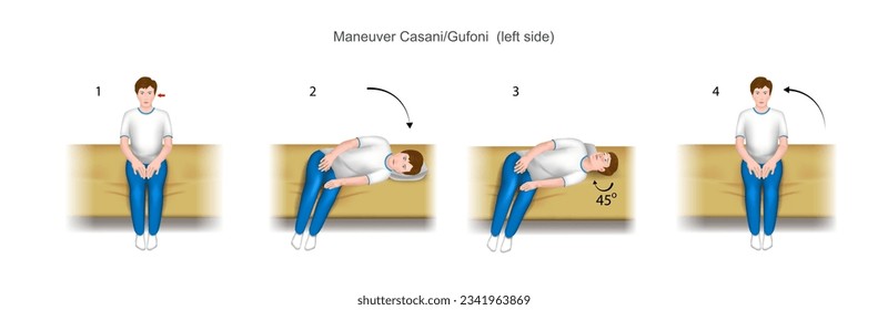 Casani Gufoni maneuver, a practical guide to the treatment of benign positional paroxysmal vertigo (bppv). With damage to the left ear. Vector. 