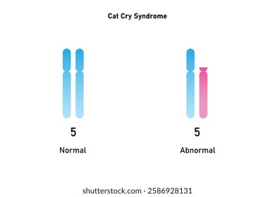 Cat Cry Syndrome Science Design. Vector Illustration.