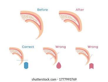 Cat And Dog Nail Trimming . Fingernail Vector