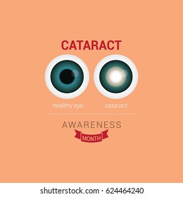 Cataract Awareness Month Design Vector.