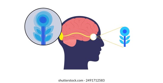 Cataract disease, eye and pupil anatomy. Lens clouding, vision impairment, and potential blindness. Vision problems during aging. Human vision loss concept. Blindness flat vector medical illustration