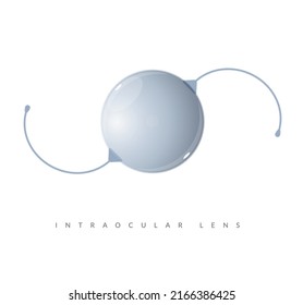 Cataract - Intraocular Lens - Illustration as EPS 10 File