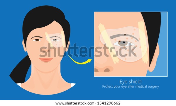 cataract\
surgery eye shield lasik operation corneal transplant Vitrectomy\
Trabeculectomy wearing protective eye\
shield