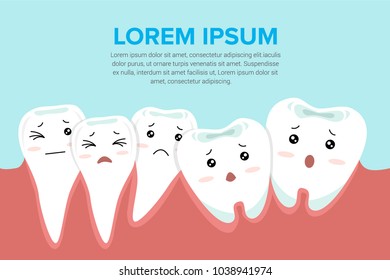 Zahn-Zahn-Menge. Dentalproblem-Konzept, Illustration.