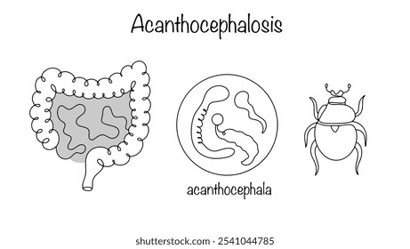 The causative agent of the disease is Acanthocevalosis. Helminths that a person can become infected with by eating beetles and insects. Parasitic disease of humans and animals. Acanthocephalosis.