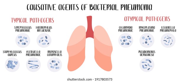 Causative agents of bacterial pneumonia. Acute respiratory tract infections. Typical and atypical pathogens (cocci, bacilli). Morphology. Microbiology. Vector flat illustration