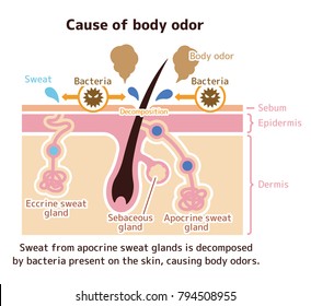 Cause of body odor illustration (English) 