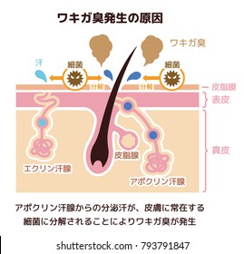 Cause of body odor illustration (japanese). Apocrine sweat gland,Eccrine sweat gland ,etc