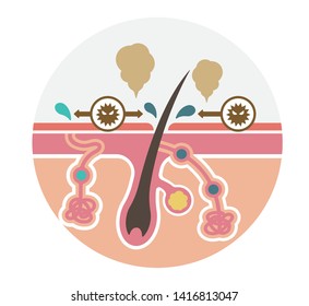 Cause of body odor vector flat illustration (round shape) / no text. 