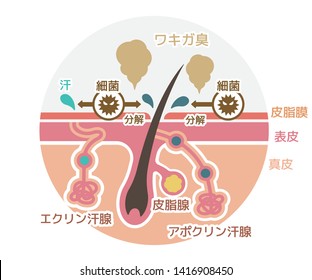 
Cause of body odor vector flat illustration (round shape) / Japanese. translation: Body odor, Bacteria, Sweat, Sebum, Epidermis, Dermis, Eccrine sweat gland, Sebaceous gland, Apocrine sweat gland.