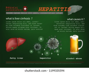 Cause of Liver disease infographic​