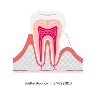 Cause and mechanism of Sensitive teeth vector illustration / no text