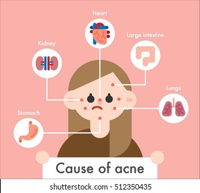 Cause of skin trouble vector illustration flat design