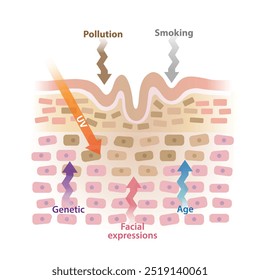 Causa de rugas na ilustração do vetor da camada da pele isolada no fundo branco. Idade, radiação ultravioleta, tabagismo, poluição, expressões faciais, genéticas causam formação de linhas e dobras na pele.