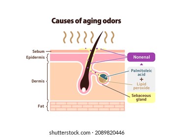 Causes of aging odors vector illustration