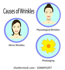Causes of aging, vector illustration reasons of aging, types of wrinkles on the white background