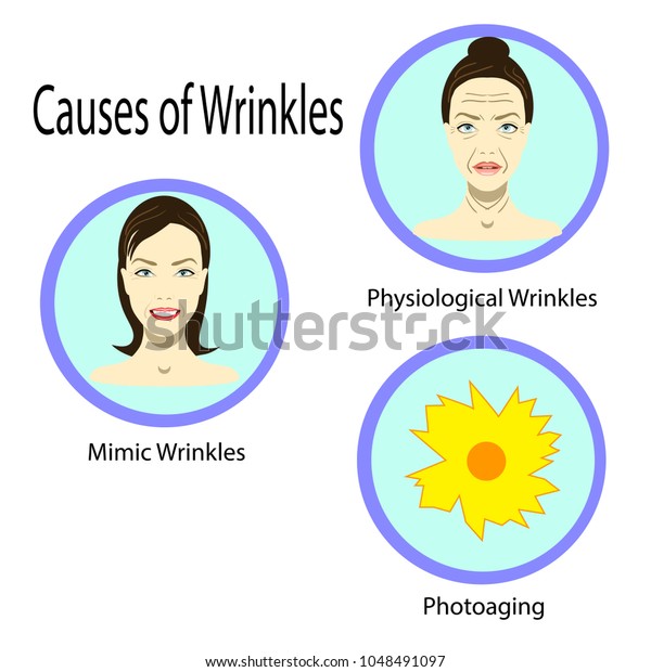 Causes Aging Vector Illustration Reasons Aging Stock Vector (Royalty ...