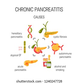 Causes Of Chronic Pancreatitis. Medical Vector Concept.