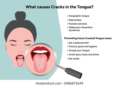 Causes cracks in tongue medical information