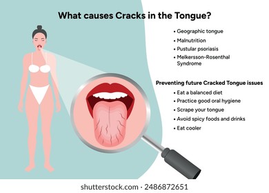 Causes cracks in tongue medical information