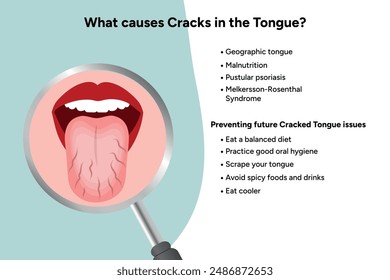 Causes cracks in tongue medical information