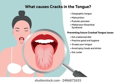 Causes cracks in tongue medical information