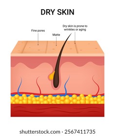 Causes of the Dry Skin