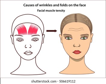 Causes of folds and wrinkles on the face of young woman. Facial muscle tensity