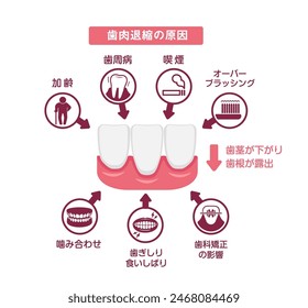 Causas de recesión gingival. Ilustración vectorial. Traducción: Causas de la recesión gingival, Envejecimiento, Enfermedad periodontal, Tabaquismo, Sobre cepillado, Mala mordida, rechinar de dientes, Ortodoncia.