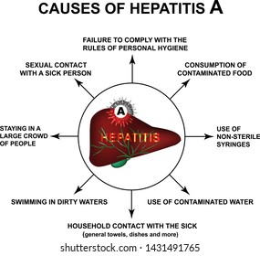 Causes of Hepatitis A. World Hepatitis Day. Infographics. Vector illustration on isolated background.