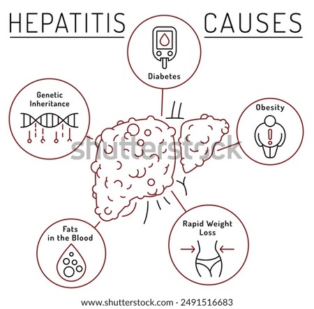 Causes of hepatitis. Hep precaution. Obesity, diabetes, genetics, weight loss. Landscape medical Poster. Global community campaign. Medicine, healthcare concept in outline style. Vector illustration