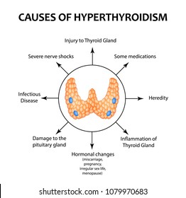 The causes of hyperthyroidism of the thyroid gland. Infographics. Vector illustration on isolated background.