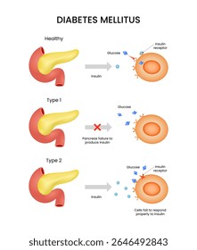 Causas e mecanismos dos tipos de diabetes