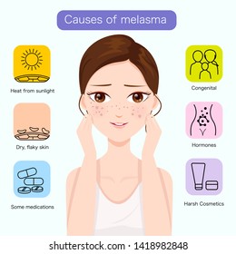 Causes Of Melasma On The Face