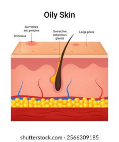 The Causes of Oily Skin